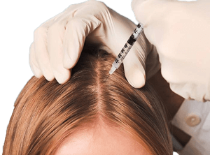 sac-mezoterapisi-101