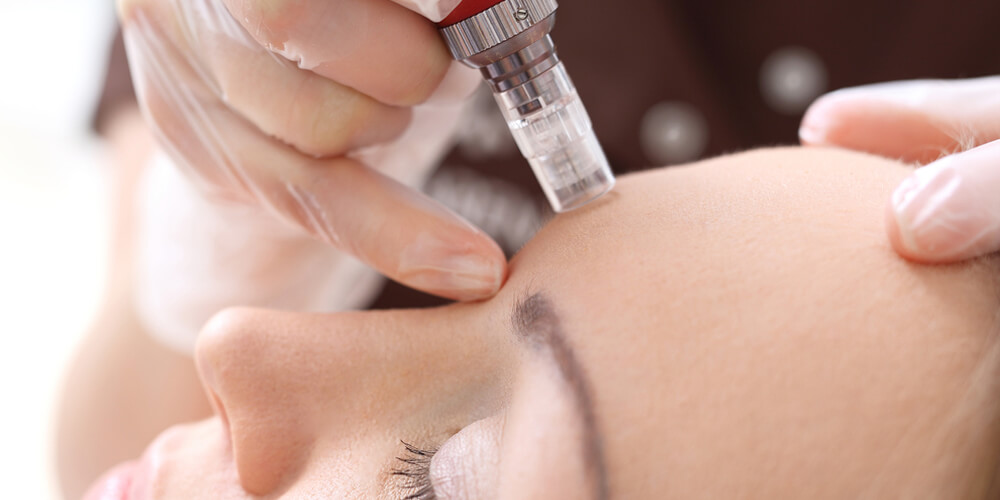 yuz_mezoterapisi_101